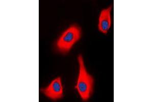Immunofluorescent analysis of PTHR1 staining in HEK293T cells. (PTH1R 抗体  (Center))