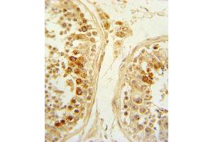 Formalin-fixed and paraffin-embedded human testis tissue reacted with SFRP1 Antibody (N-term), which was peroxidase-conjugated to the secondary antibody, followed by DAB staining. (SFRP1 抗体  (N-Term))