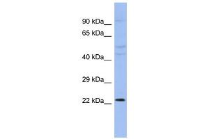 WB Suggested Anti-CBX1 Antibody Titration:  0. (CBX1 抗体  (N-Term))