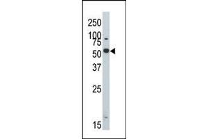 The anti-DYRK2 Pab (ABIN391770 and ABIN2841632) is used in Western blot to detect DYRK2 in 293 cell lysate. (DYRK2 抗体  (N-Term))