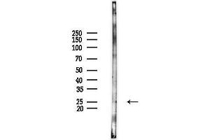 anti-Glutathione S-Transferase theta 2B (GSTT2B) (Internal Region) antibody