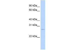 WB Suggested Anti-RBM38 Antibody Titration:  0. (RBM38 抗体  (N-Term))
