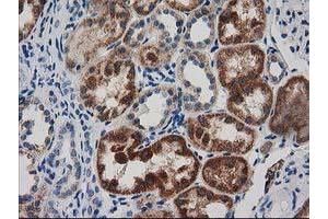 Immunohistochemical staining of paraffin-embedded Human Kidney tissue using anti-GRHPR mouse monoclonal antibody. (GRHPR 抗体)