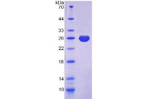 SDS-PAGE (SDS) image for Ubiquitin Carboxyl-terminal Esterase L1 (Ubiquitin Thiolesterase) (UCHL1) (C-Term) protein (ABIN3012120)