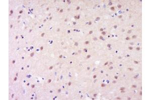 Paraformaldehyde-fixed, paraffin embedded rat brain, Antigen retrieval by boiling in sodium citrate buffer (pH6) for 15min, Block endogenous peroxidase by 3% hydrogen peroxide for 30 minutes, Blocking buffer (normal goat serum) at 37°C for 20min, Antibody incubation with Rabbit Anti-GSC Polyclonal Antibody, Unconjugated  at 1:200 overnight at 4°C, followed by a conjugated secondary and DAB staining. (GSC 抗体  (AA 151-257))