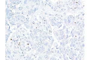 anti-Forkhead Box P3 (FOXP3) (AA 275-325) antibody