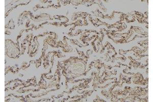 ABIN6277309 at 1/100 staining Human lung tissue by IHC-P. (KRT4 抗体)