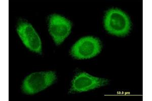 Immunofluorescence of purified MaxPab antibody to RPN2 on HeLa cell. (Ribophorin II 抗体  (AA 1-631))
