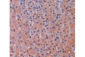 Used in DAB staining on fromalin fixed paraffin- embedded Kidney tissue