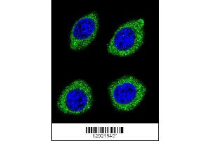 Confocal immunofluorescent analysis of HSD11B1L Antibody with U-251MG cell followed by Alexa Fluor 488-conjugated goat anti-rabbit lgG (green). (HSD11B1L 抗体  (C-Term))