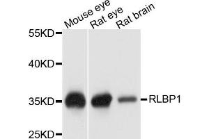 Western blot analysis of extract of various cells, using RLBP1 antibody. (RLBP1 抗体)