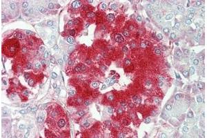 Immunohistochemistry (IHC) image for anti-Tumor Necrosis Factor Receptor Superfamily, Member 21 (TNFRSF21) (AA 356-385) antibody (ABIN1942955)