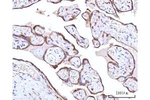 IHC analysis of RPN1 using anti-RPN1 antibody (ABIN7600447). (RPN1 抗体  (AA 196-495))