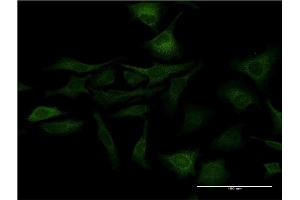 Immunofluorescence of monoclonal antibody to SFN on HeLa cell. (14-3-3 sigma/SFN 抗体  (AA 1-248))