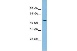 WB Suggested Anti-C17orf75 Antibody Titration: 0. (C17orf75 抗体  (Middle Region))