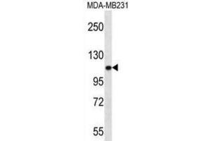 Western Blotting (WB) image for anti-Actinin, alpha 3 (ACTN3) antibody (ABIN2996665) (ACTN3 抗体)