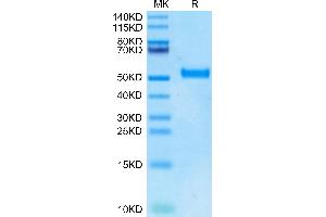 Biotinylated Human DKK1 N terminal Domain on Tris-Bis PAGE under reduced condition. (DKK1 Protein (N-Term) (Fc-Avi Tag,Biotin))