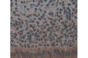 Used in DAB staining on fromalin fixed paraffin- embedded Kidney tissue (TRRAP 抗体  (AA 3534-3770))