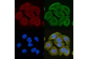 ABIN6260056 and ABIN6272251 staining Hela cells(30 min of UV treatment) by IF/ICC. (ARRDC4 抗体  (Internal Region))