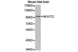 Western Blotting (WB) image for anti-Nuclear Factor of Activated T-Cells, Cytoplasmic, Calcineurin-Dependent 2 (NFAT1) antibody (ABIN1873890) (NFAT1 抗体)