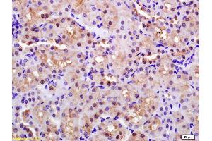 Formalin-fixed and paraffin embedded rat kidney labeled with Anti-CAP1/PARK7 Polyclonal Antibody, Unconjugated (ABIN674739) at 1:200 followed by conjugation to the secondary antibody and DAB staining. (PARK7/DJ1 抗体  (AA 101-189))