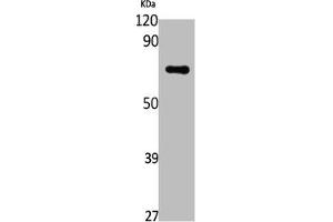 Western Blot analysis of Jurkat cells using DNA pol ε B Polyclonal Antibody (POLE2 抗体  (Internal Region))