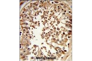 Formalin-fixed and paraffin-embedded human testis tissue reacted with DMC1 Antibody (N-term), which was peroxidase-conjugated to the secondary antibody, followed by DAB staining. (DMC1 抗体  (N-Term))