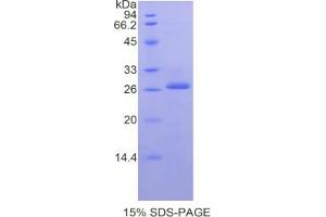 SDS-PAGE analysis of Mouse Kallikrein 3 Protein. (Prostate Specific Antigen Protein (PSA))