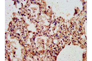 IHC image of ABIN7143473 diluted at 1:300 and staining in paraffin-embedded human lung tissue performed on a Leica BondTM system. (ARL1 抗体  (AA 2-181))