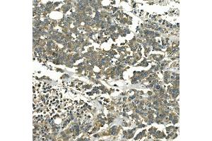 IHC analysis of Galectin 2/LGALS2 using anti-Galectin 2/LGALS2 antibody (ABIN7598979).