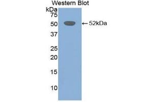 Detection of Recombinant FGb, Mouse using Polyclonal Antibody to Fibrinogen Beta Chain (FGB) (Fibrinogen beta Chain 抗体  (AA 35-481))