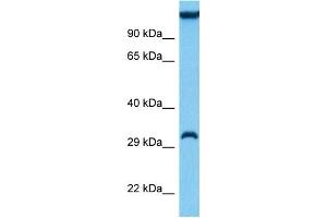Host:  Mouse  Target Name:  SIAH1A  Sample Tissue:  Mouse Liver  Antibody Dilution:  1ug/ml (SIAH1 抗体  (N-Term))