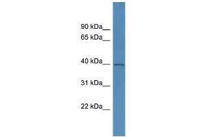 WB Suggested Anti-PHYHIPL Antibody Titration: 0. (PHYHIPL 抗体  (C-Term))