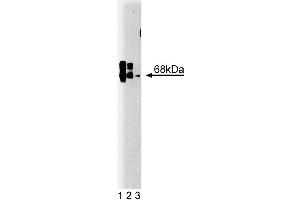 Western blot analysis of CaM Kinase Kinase on rat brain lysate. (CaM Kinase Kinase (AA 341-504) 抗体)