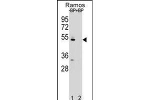 Western blot analysis of ZDHC2 Antibody (N-term) Pab (ABIN651781 and ABIN2840397) pre-incubated without(lane 1) and with(lane 2) blocking peptide in Ramos cell line lysate. (ZDHHC2 抗体  (AA 77-106))