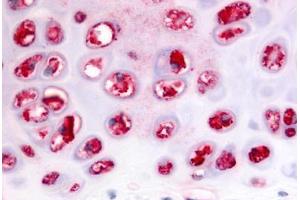 Anti-ADAMTS5 antibody  ABIN1048296 IHC staining of human cartilage.