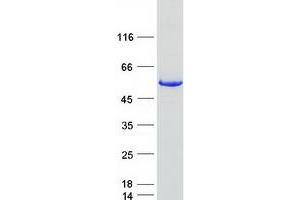 Validation with Western Blot