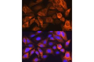 Immunofluorescence analysis of U-2 OS cells using F Rabbit mAb (ABIN7267150) at dilution of 1:100 (40x lens). (FABP1 抗体)