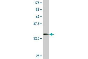 Western Blot detection against Immunogen (36. (Keratin 34 抗体  (AA 337-436))