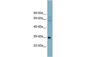 WB Suggested Anti-Alpha-DAG1 Antibody Titration:  0. (Dystroglycan 抗体  (Middle Region))