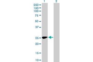 Western Blot analysis of MMACHC expression in transfected 293T cell line by MMACHC MaxPab polyclonal antibody. (MMACHC 抗体  (AA 1-225))