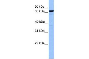 WB Suggested Anti-MTA2 Antibody Titration:  0.