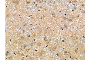 Phospho-53BP1 (Ser25/Ser29) Antibody at 1/100 staining Rat brain tissue by IHC-P. (TP53BP1 抗体  (pSer25, pSer29))