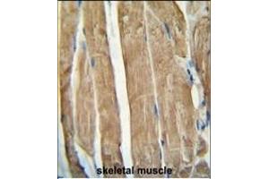 PG antibody (N-term) (ABIN654461 and ABIN2844194) immunohistochemistry analysis in formalin fixed and paraffin embedded human skeletal muscle followed by peroxidase conjugation of the secondary antibody and DAB staining. (PGAM2 抗体  (N-Term))