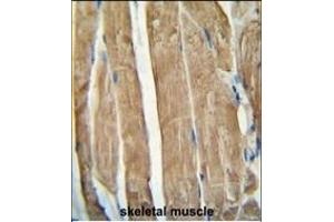 PG antibody (N-term) (ABIN654461 and ABIN2844194) immunohistochemistry analysis in formalin fixed and paraffin embedded human skeletal muscle followed by peroxidase conjugation of the secondary antibody and DAB staining. (PGAM2 抗体  (N-Term))