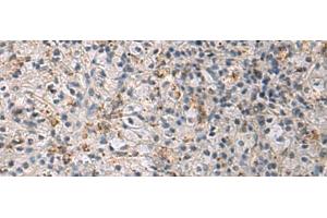 Immunohistochemistry of paraffin-embedded Human brain tissue using IRS4 Polyclonal Antibody at dilution of 1:45(x200) (IRS4 抗体)