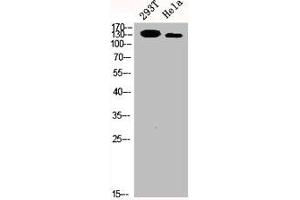 Western Blot analysis of 293T HELA cells using p140Cap Polyclonal Antibody (SRCIN1 抗体  (Internal Region))