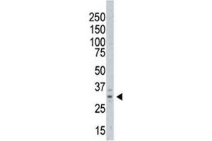 Western blot testing of AURKC antibody and A375 cell lysate. (Aurora Kinase C 抗体  (C-Term))