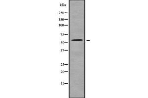 Western blot analysis SLC22A17 using K562 whole cell lysates (SLC22A17 抗体  (C-Term))