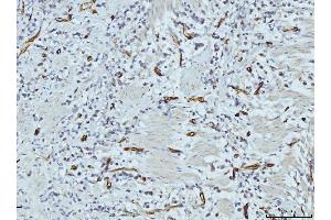 IHC analysis of FABP4 using anti-FABP4 antibody (ABIN7603145).